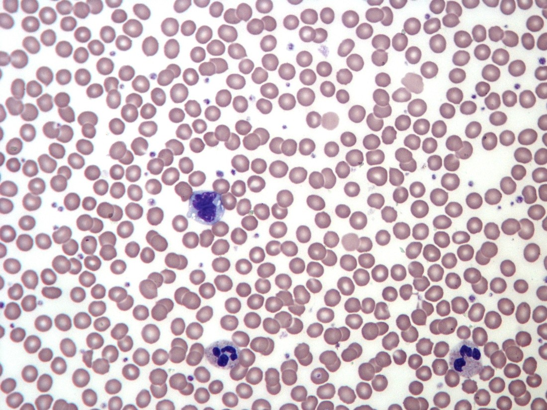 Real Giemsa-stained blood smear showing blood as specialised connective tissue